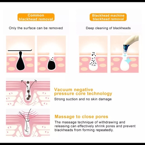 Microdermabrasion kit - Picture 2 of 4